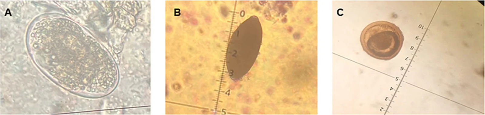 Huevos encontrados en el suelo de plazas de Valdivia: (A) Uncinaria stenocephala, (B) Trichuris vulpis y (C) Toxocara sp.