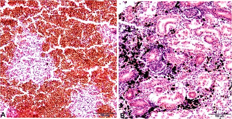 Cortes histológicos de trucha arcoíris infectada con Y. ruckeri, tinción H&E. (A) Necrosis multifocal en el bazo. (B) Degeneración del tejido intersticial y aumento marcado de melanomacrófagos en el riñón.